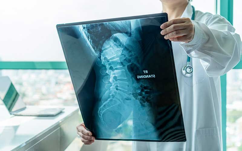 Symptoms of Spinal Stenosis - Spinal Stenosis