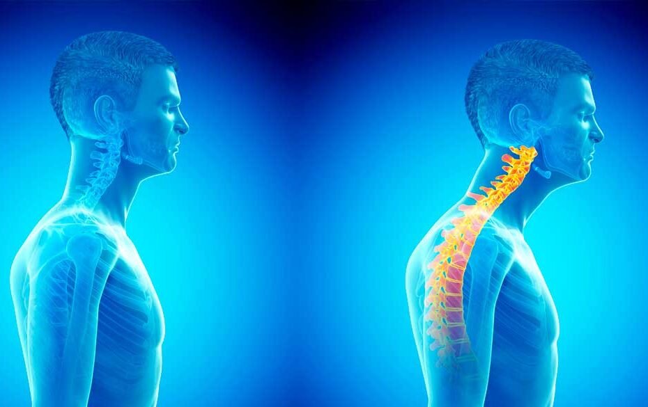 Forward Head Posture - mouth and jaw