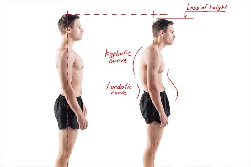 Three Major Types of Rehabilitation for Spinal Conditions Used by Structural Correction Chiropractors - Structural Correction Chiropractors
