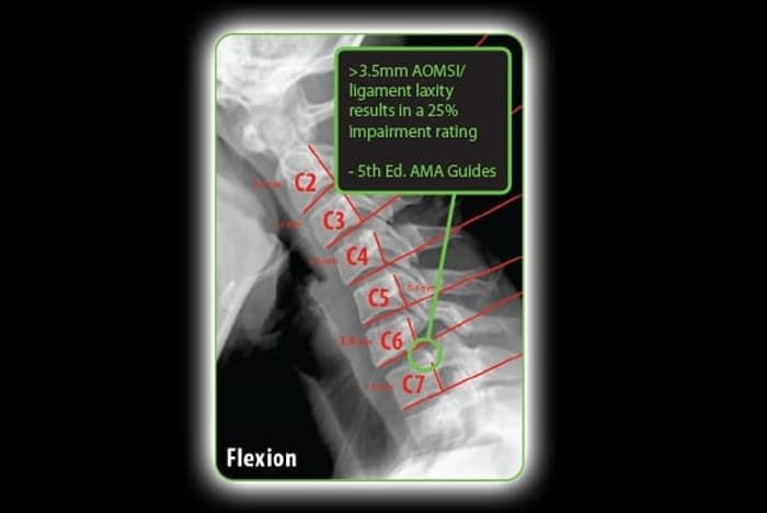 What Makes Structural Correction Chiropractic Different Than Other Healthcare Protocols and Treatments? . The optimal global and segmental shape of the human spinal structure is designed to resist this ongoing relentless downward force and distribute its body weight symmetrically around this vertical axis of gravity