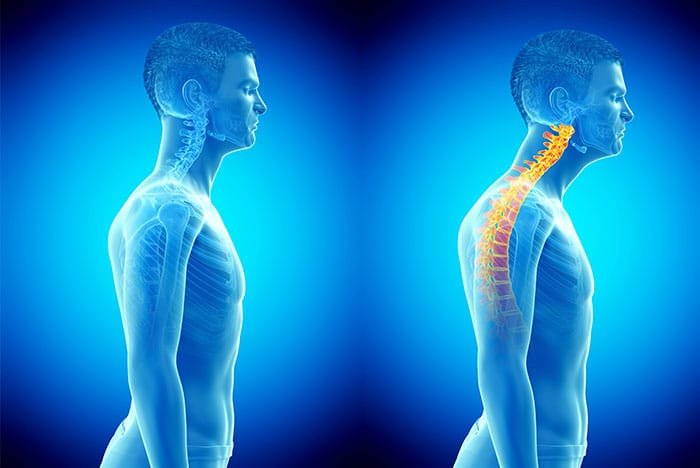 Comparison of Sensorimotor Integration and Skill-Related Physical Fitness Components Between College Athletes With and Without Forward Head Posture. College athletes with FHP exhibited altered sensorimotor processing and integration measurements and less efficient skill-related physical fitness compared with athletes with normal sagittal head posture alignment