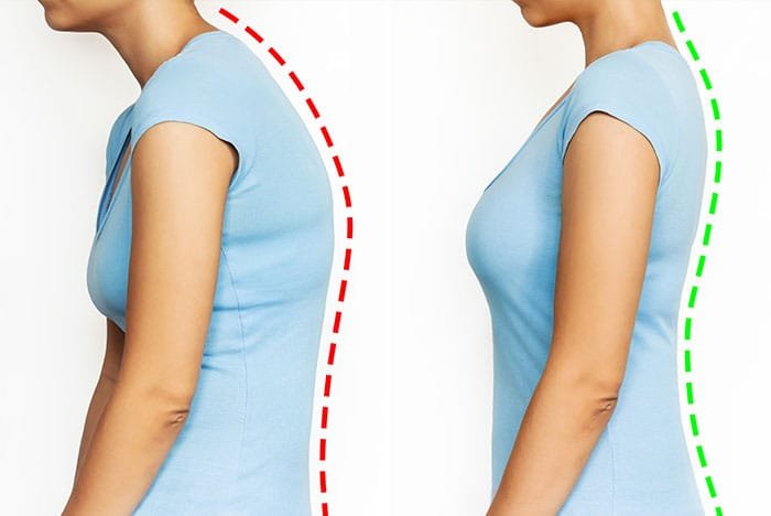 : Sunset Chiropractic & Wellness Research Review: Compensation for standing posture by whole-body sagittal alignment in relation to health-related quality of life.Lumbar spinal stenosis was found to be associated with the symptom severity.