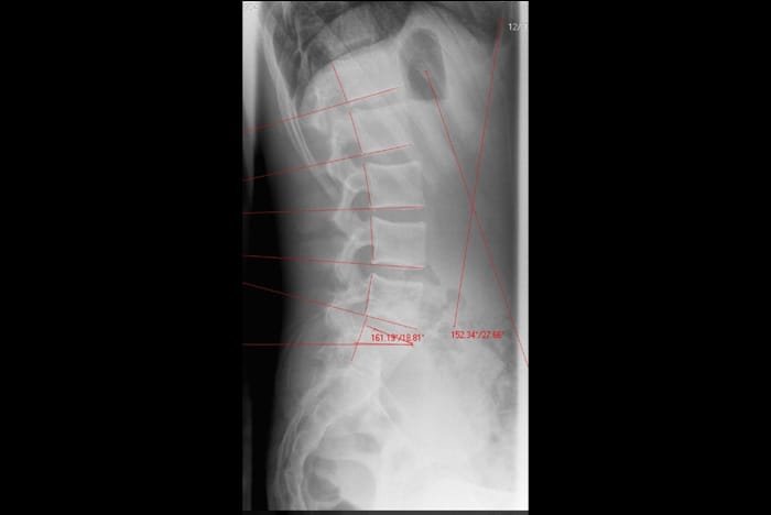 Sunset Chiropractic & Wellness. Unique Diagnosis and Treatment System. We utilize sitting x-rays because it puts 50% more stress load on the spinal structures and allows us to identify and diagnose spinal system damage and failures that do not show up in recumbent MRI and CT scan or standing x-ray.
