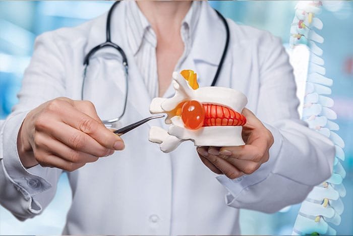 Sunset Chiropractic and Wellness. Loss of Cervical Lordosis Causing Disc Herniation? Cervical lordosis is a natural curvature of the spine that helps to support the weight of the head and neck. When this curve is lost, it can put stress on the discs in the spine, which can lead to disc herniation.